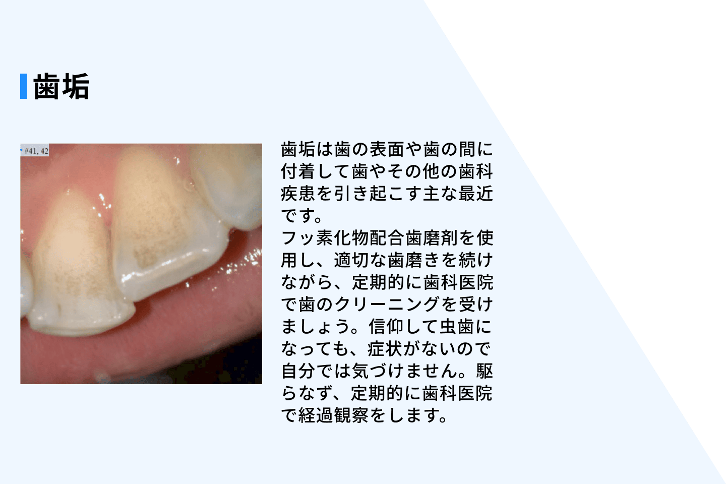 オーラルヘルスレポートのイメージ2